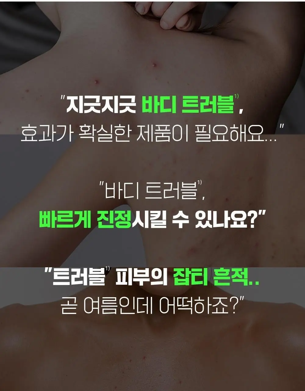 [트러블흔적/단독기획] 파티온 노스카나인 트러블 바디 미스트 145ml 기획(바디워시5ml*4ea) 상세페이지 6